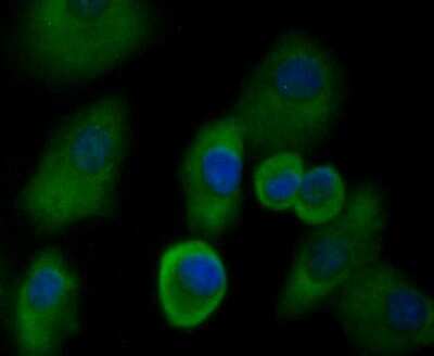 Immunocytochemistry/Immunofluorescence: UAP1 Antibody (4H1) [NBP2-75694] - Staining UAP1 (green) in A549 cells. The nuclear counter stain is DAPI (blue). Cells were fixed in paraformaldehyde, permeabilised with 0.25% Triton X100/PBS.