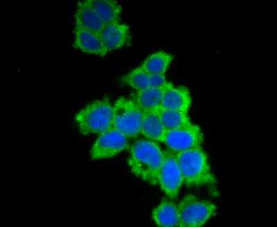 Immunocytochemistry/Immunofluorescence: UAP1 Antibody [NBP2-76970] - ICC staining UAP1 in 293T cells (green). The nuclear counter stain is DAPI (blue). Cells were fixed in paraformaldehyde, permeabilised with 0.25% Triton X100/PBS.
