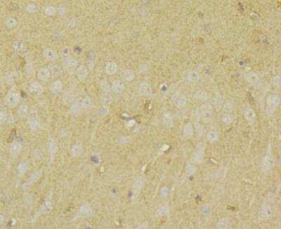 Immunohistochemistry: UAP1 Antibody [NBP2-76970] - Immunohistochemical analysis of paraffin-embedded rat brain tissue using anti-UAP1 antibody. Counter stained with hematoxylin.