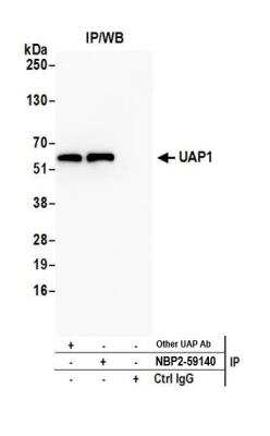 Immunoprecipitation: UAP1 Antibody [NBP2-59140] - Detection of human UAP1 by western blot of immunoprecipitates. Samples: Whole cell lysate (0.5 or 1.0 mg per IP reaction; 20% of IP loaded) from Jurkat cells prepared using NETN lysis buffer. Antibodies: Affinity purified rabbit anti-UAP1 antibody NBP2-59140 used for IP at 20 ul per reaction. UAP1 was also immunoprecipitated by another rabbit anti-UAP1 antibody. For blotting immunoprecipitated UAP1, NBP2-59140 was used at 1:100. Detection: Chemiluminescence with an exposure time of 30 seconds.