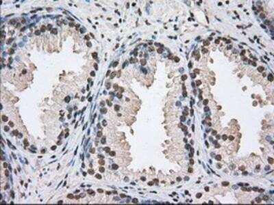 Immunohistochemistry-Paraffin: UAP56 Antibody (2C5) [NBP2-02553] - Staining of paraffin-embedded Human prostate tissue using anti-UAP56 mouse monoclonal antibody.