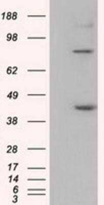 Western Blot: UAP56 Antibody (2C5) [NBP2-02553] - HEK293T cells were transfected with the pCMV6-ENTRY control (Left lane) or pCMV6-ENTRY UAP56 (Right lane) cDNA for 48 hrs and lysed. Equivalent amounts of cell lysates (5 ug per lane) were separated by SDS-PAGE and immunoblotted with anti-UAP56.