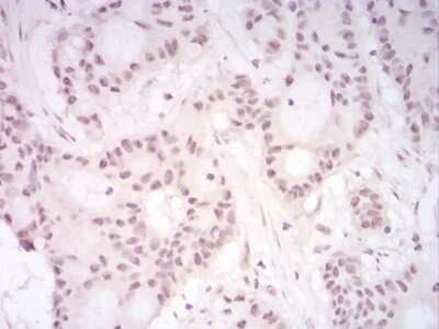 Immunohistochemistry: UAP56 Antibody (2F5G7) [NBP2-52455] - Analysis of paraffin-embedded HeLa tissues using DDX39B mouse mAb with DAB staining.