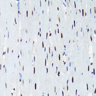 Immunohistochemistry-Paraffin: UAP56 Antibody (4A0Q2) [NBP3-16873] - Immunohistochemistry of paraffin-embedded rat heart using UAP56 Rabbit mAb (NBP3-16873) at dilution of 1:100 (40x lens).Perform microwave antigen retrieval with 10 mM Tris/EDTA buffer pH 9.0 before commencing with IHC staining protocol.