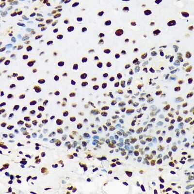 Immunohistochemistry-Paraffin: UAP56 Antibody (4A0Q2) [NBP3-16873] - Immunohistochemistry of paraffin-embedded human esophageal using UAP56 Rabbit mAb (NBP3-16873) at dilution of 1:100 (40x lens).Perform microwave antigen retrieval with 10 mM Tris/EDTA buffer pH 9.0 before commencing with IHC staining protocol.