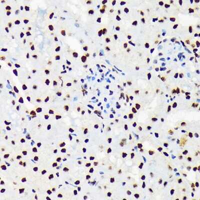 Immunohistochemistry-Paraffin: UAP56 Antibody (4A0Q2) [NBP3-16873] - Immunohistochemistry of paraffin-embedded mouse kidney using UAP56 Rabbit mAb (NBP3-16873) at dilution of 1:100 (40x lens).Perform microwave antigen retrieval with 10 mM Tris/EDTA buffer pH 9.0 before commencing with IHC staining protocol.