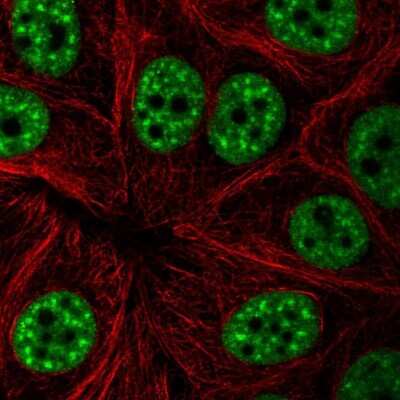 <b>Orthogonal Strategies Validation. </b>Immunocytochemistry/Immunofluorescence: UAP56 Antibody [NBP2-58594] - Staining of human cell line MCF7 shows localization to nuclear speckles. Antibody staining is shown in green.