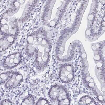 Immunohistochemistry-Paraffin: UAP56 Antibody [NBP2-58594] - Staining of human duodenum shows low expression as expected.