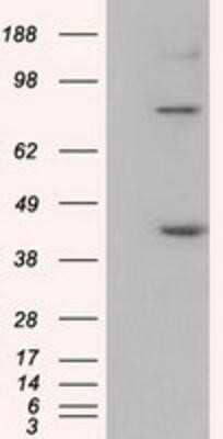 Western Blot: UAP56 Antibody (OTI2C5) - Azide and BSA Free [NBP2-74727] - HEK293T cells were transfected with the pCMV6-ENTRY control (Left lane) or pCMV6-ENTRY UAP56 (Right lane) cDNA for 48 hrs and lysed. Equivalent amounts of cell lysates (5 ug per lane) were separated by SDS-PAGE and immunoblotted with anti-UAP56.