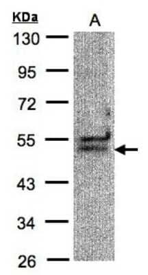 Western Blot: UAP56 Antibody [NBP1-32173] - Sample(30 ug of whole cell lysate)A:Hep G2 10% SDS PAGE, antibody diluted at 1:1000.