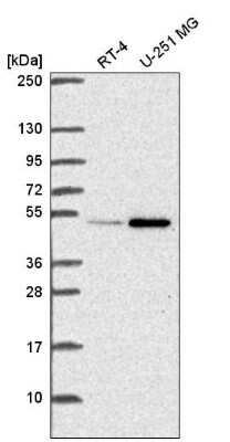 Western Blot: UAP56 Antibody [NBP2-58594] - Western blot analysis in human cell line RT-4 and human cell line U-251 MG.