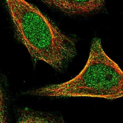 Immunocytochemistry/Immunofluorescence: UBA3 Antibody [NBP2-49443] - Immunofluorescent staining of human cell line SiHa shows localization to nucleoplasm, plasma membrane & centrosome.