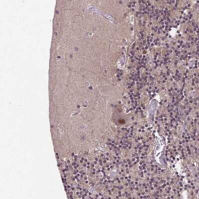 Immunohistochemistry-Paraffin UBA3 Antibody