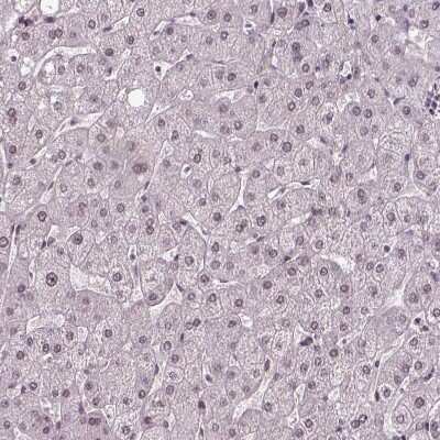 Immunohistochemistry-Paraffin UBA3 Antibody