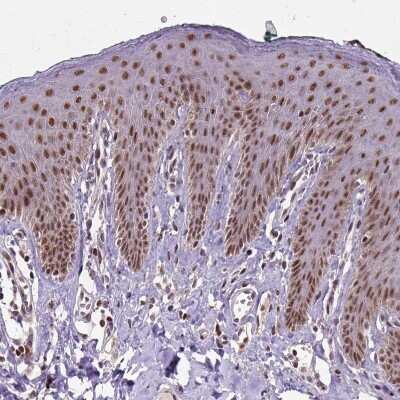 Immunohistochemistry-Paraffin: UBA3 Antibody [NBP2-48628] - Staining of human skin shows moderate nuclear positivity in epidermal cells.