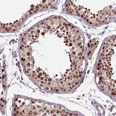 Immunohistochemistry-Paraffin: UBA3 Antibody [NBP2-48628] - Staining of human testis shows strong nuclear positivity.