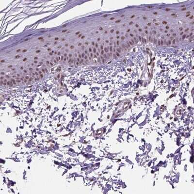 Immunohistochemistry-Paraffin: UBA3 Antibody [NBP2-49443] - Staining of human skin shows high expression.