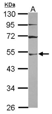 Western Blot: UBA3 Antibody [NBP2-20777] - Sample (30 ug of whole cell lysate) A: A431 10% SDS PAGE gel, diluted at 1:3000.