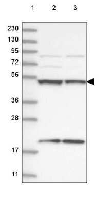 Western Blot UBA3 Antibody