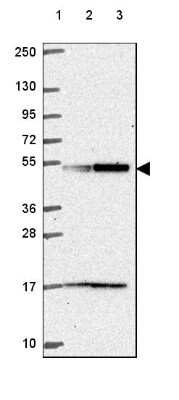 <b>Orthogonal Strategies Validation. </b>Western Blot: UBA3 Antibody [NBP2-49443] - Lane 1: Marker [kDa] 250, 130, 95, 72, 55, 36, 28, 17, 10Lane 2: Human cell line RT-4Lane 3: Human cell line U-251 MG