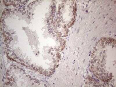 Immunohistochemistry: UBA52 Antibody (4F2) [NBP2-46261] - Analysis of Human prostate tissue. (Heat-induced epitope retrieval by 1mM EDTA in 10mM Tris buffer (pH8.5) at 120C for 3 min)