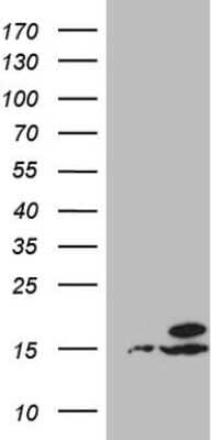 Western Blot: UBA52 Antibody (4F2) [NBP2-46261] - Analysis of HEK293T cells were transfected with the pCMV6-ENTRY control (Left lane) or pCMV6-ENTRY UBA52.