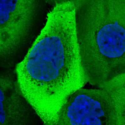 Immunocytochemistry/Immunofluorescence: UBA52 Antibody [NBP2-55293] - Staining of human cell line A-431 shows localization to nucleoplasm, plasma membrane, cytosol & endoplasmic reticulum.