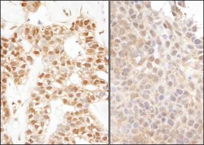 Immunohistochemistry UBA52 Antibody