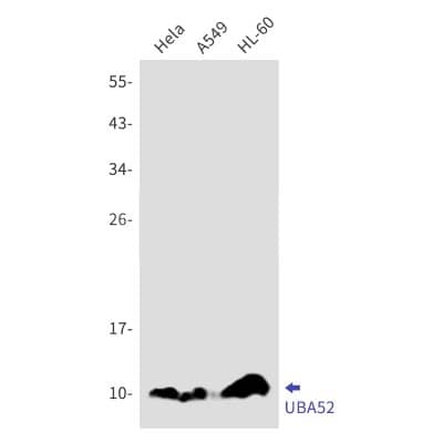 Western Blot: UBA52 Antibody (S05-5D6) [NBP3-20009] - Western blot detection of UBA52 in Hela, A549, HL-60 cell lysates using NBP3-20009 (1:1000 diluted). Predicted band size: 15kDa. Observed band size: 10kDa.