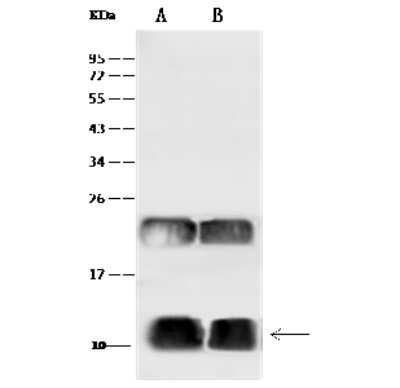 Western Blot: UBA52 Antibody [NBP2-99383] - Anti-UBA52 rabbit polyclonal antibody at 1:500 dilution. Lane A: 293T Whole Cell Lysate Lane B: Raji Whole Cell Lysate Lysates/proteins at 30 ug per lane. Secondary Goat Anti-Rabbit IgG (H+L)/HRP at 1/10000 dilution. Developed using the ECL technique. Performed under reducing conditions. Predicted band size: 15 kDa. Observed band size: 12 kDa