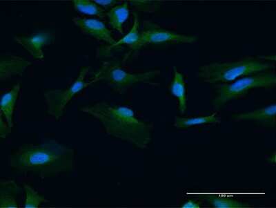 Immunocytochemistry/Immunofluorescence: UBAC1 Antibody [H00010422-B01P] - Analysis of purified antibody to UBAC1 on HeLa cell. (antibody concentration 10 ug/ml)