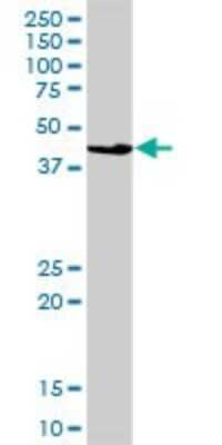 Western Blot: UBAC1 Antibody [H00010422-B01P] - Analysis of UBADC1 expression in human liver.