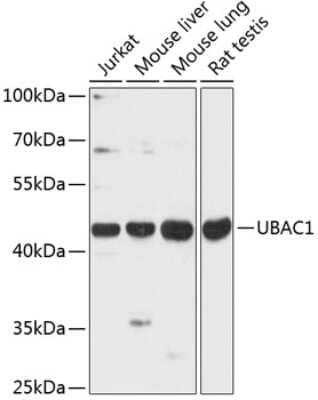 Western Blot: UBAC1 Antibody [NBP2-94250] - Analysis of extracts of various cell lines, using UBAC1 at 1:3000 dilution. Secondary antibody: HRP Goat Anti-Rabbit IgG (H+L) at 1:10000 dilution. Lysates/proteins: 25ug per lane. Blocking buffer: 3% nonfat dry milk in TBST. Detection: ECL Basic Kit . Exposure time: 30s.