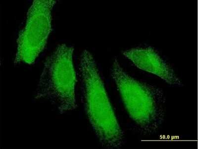 Immunocytochemistry/Immunofluorescence: UBAP1 Antibody [H00051271-B01P] - Analysis of purified antibody to UBAP1 on HeLa cell. (antibody concentration 10 ug/ml)