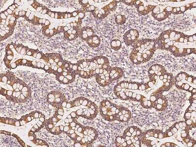 Immunohistochemistry-Paraffin UBAP1 Antibody - BSA Free