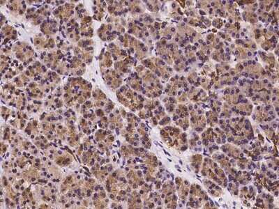 Immunohistochemistry-Paraffin UBAP1 Antibody - BSA Free