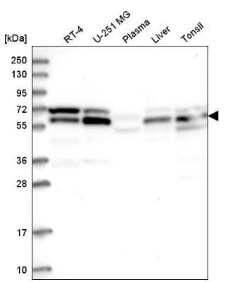 Western Blot: UBAP1 Antibody [NBP2-58969] - Analysis in human cell line RT-4, human cell line U-251 MG, human plasma, human liver tissue and human tonsil tissue.