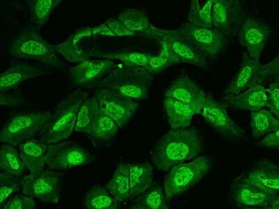 Immunocytochemistry/Immunofluorescence: UBAP2L Antibody [NBP2-97847] - Immunofluorescence staining of UBAP2L in U2OS cells. Cells were fixed with 4% PFA, permeabilzed with 0.1% Triton X-100 in PBS, blocked with 10% serum, and incubated with rabbit anti-Human UBAP2L polyclonal antibody (dilution ratio 1:200) at 4C overnight. Then cells were stained with the Alexa Fluor(R)488-conjugated Goat Anti-rabbit IgG secondary antibody (green). Positive staining was localized to Nucleus and Cytoplasm.