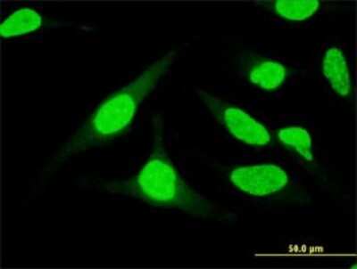 Immunocytochemistry/Immunofluorescence: UBASH3B/STS1/Tula-2 Antibody (3G7) [H00084959-M01] - Analysis of monoclonal antibody to UBASH3B on HeLa cell . Antibody concentration 10 ug/ml.