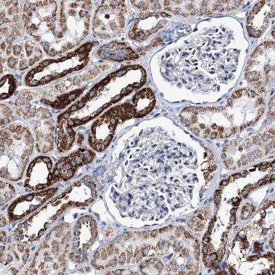Immunohistochemistry-Paraffin: UBASH3B/STS1/Tula-2 Antibody [NBP1-92456] - Staining of human kidney shows strong cytoplasmic positivity, with a granular pattern in cells in tubules.