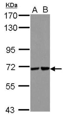 Western Blot: UBASH3B/STS1/Tula-2 Antibody [NBP2-20524] - Sample (30 ug of whole cell lysate) A: A431 B: Jurkat 7. 5% SDS PAGE gel, diluted at 1:1000.