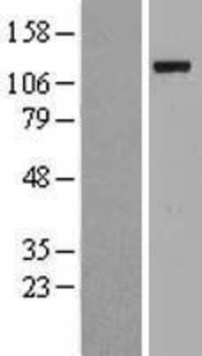 Western Blot: UBE1 Overexpression Lysate (Adult Normal) [NBL1-17495] Left-Empty vector transfected control cell lysate (HEK293 cell lysate); Right -Over-expression Lysate for UBE1.