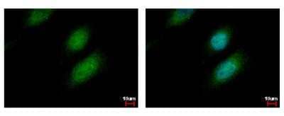 Immunocytochemistry/Immunofluorescence: UBE2A Antibody [NBP2-20780] - Sample: HeLa cells were fixed in 4% paraformaldehyde at RT for 15 min. Green: UBE2A protein stained by UBE2A antibody diluted at 1:500. Blue: Hoechst 33342 staining.