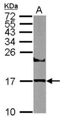 Western Blot: UBE2A Antibody [NBP2-20780] - Sample (50 ug of whole cell lysate) A: Mouse Brain, 15% SDS PAGE gel, diluted at 1:500.