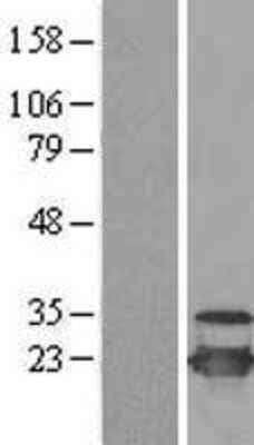 Western Blot: UBE2C Overexpression Lysate (Adult Normal) [NBL1-17514] Left-Empty vector transfected control cell lysate (HEK293 cell lysate); Right -Over-expression Lysate for UBE2C.