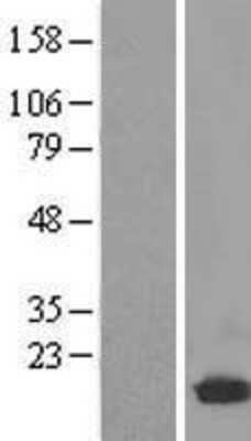 Western Blot: UBE2D2 Overexpression Lysate (Adult Normal) [NBL1-17519] Left-Empty vector transfected control cell lysate (HEK293 cell lysate); Right -Over-expression Lysate for UBE2D2.