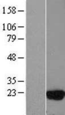 Western Blot: UBE2D3 Overexpression Lysate (Adult Normal) [NBL1-17521] Left-Empty vector transfected control cell lysate (HEK293 cell lysate); Right -Over-expression Lysate for UBE2D3.