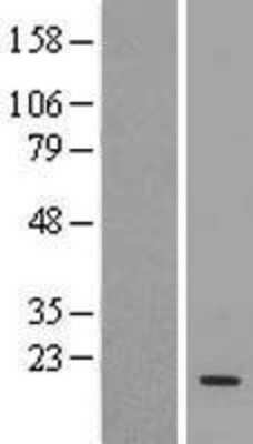 Western Blot: UBE2D3 Overexpression Lysate (Adult Normal) [NBL1-17522] Left-Empty vector transfected control cell lysate (HEK293 cell lysate); Right -Over-expression Lysate for UBE2D3.