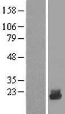 Western Blot UBE2D4/Ubch5d Overexpression Lysate
