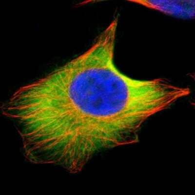 Immunocytochemistry/Immunofluorescence: UbcH5b/UBE2D2 Antibody [NBP1-81769] - Staining of human cell line U-251 MG shows localization to plasma membrane & cytosol. Antibody staining is shown in green.